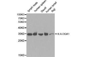 Western blot analysis of extracts of various cell lines, using HLA-DQA1 antibody. (HLA-DQA1 抗体  (AA 24-216))