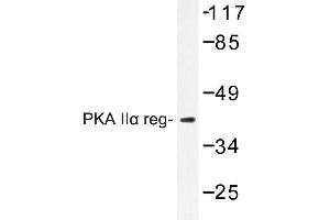 Image no. 1 for anti-Protein Kinase, CAMP-Dependent, Regulatory, Type II, alpha (PRKAR2A) antibody (ABIN272166)