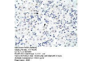 Rabbit Anti-HNRPL Antibody  Paraffin Embedded Tissue: Human Liver Cellular Data: Hepatocytes Antibody Concentration: 4. (HNRNPL 抗体  (N-Term))
