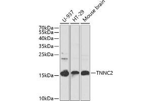Western blot analysis of extracts of various cell lines, using TNNC2 antibody (ABIN6129604, ABIN6149353, ABIN6149354 and ABIN6223680) at 1:1000 dilution. (TNNC2 抗体  (AA 1-160))