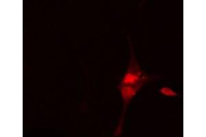 ABIN6269134 staining Hela cells by IF/ICC. (BCR 抗体  (N-Term))