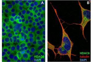 Immunocytochemistry staining of HDAC6 in formaldehyde-fixed and Triton-permeabilized HEK-293T cells (A) and SH-SY5Y cells (B) by mouse monoclonal antibody 159, followed by anti-mouse Alexa Fluor 488 (green), DNA indicated by DAPI (blue). (HDAC6 抗体)