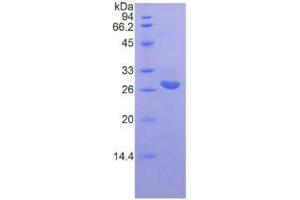 SDS-PAGE analysis of Rat IL22Ra2 Protein. (IL22RA2 蛋白)