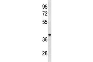 ACAA1 antibody western blot analysis in human 293 lysate. (ACAA1 抗体  (AA 147-176))