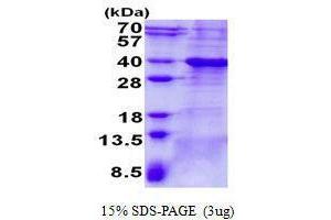 Figure annotation denotes ug of protein loaded and % gel used. (BCL7A 蛋白)