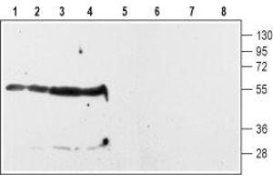Western blot analysis of rat striatum (lanes 1 and 5) and hippocampus (lanes 2 and 6) membranes and of rat (lanes 3 and 7) and mouse (lanes 4 and 8) whole brain lysates: - 1-4.