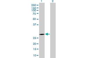 Western Blot analysis of KCTD6 expression in transfected 293T cell line by KCTD6 MaxPab polyclonal antibody. (KCTD6 抗体  (AA 1-237))