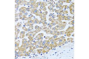 Immunohistochemistry of paraffin-embedded human liver using COL10A1 antibody (ABIN5974149) at dilution of 1/100 (40x lens). (COL10A1 抗体)