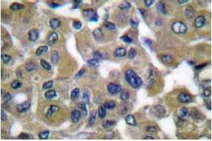 Image no. 1 for anti-Keratin 7 (KRT7) antibody (ABIN265502) (Cytokeratin 7 抗体)