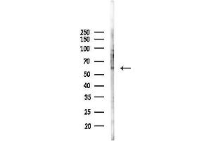 anti-Carboxypeptidase N Subunit 2 (CPN2) (C-Term) antibody