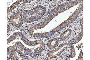IHC analysis of TRMT10C using anti-TRMT10C antibody (ABIN7601472).