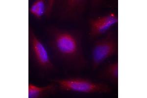 Immunofluorescence staining of methanol-fixed HeLa cells using Phospho-NTRK1-S791 antibody (ABIN2987788). (TRKA 抗体  (pSer791))