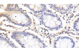 Immunohistochemistry (IHC) image for anti-ATP-Binding Cassette, Sub-Family B (MDR/TAP), Member 10 (ABCB10) (AA 492-738) antibody (ABIN7444994)
