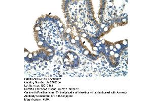 Rabbit Anti-CPNE1 Antibody  Paraffin Embedded Tissue: Human Intestine Cellular Data: Epithelial cells of intestinal villas Antibody Concentration: 4. (CPNE1 抗体  (N-Term))