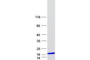 Validation with Western Blot