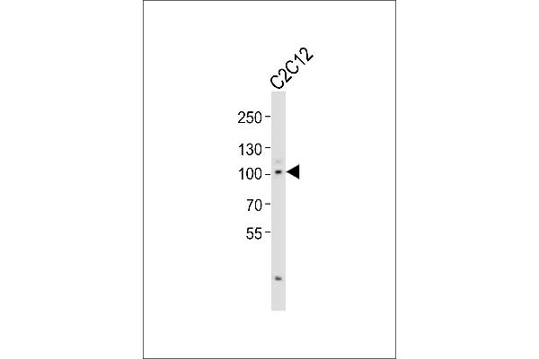 Myocardin 抗体  (C-Term)