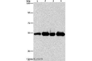 Western blot analysis of Human bladder carcinoma tissue and A172 cell, human fetal brain tissue and hela cell, using PDE4D Polyclonal Antibody at dilution of 1:500