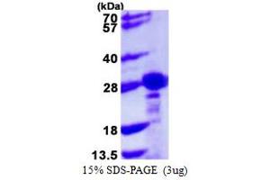 SDS-PAGE (SDS) image for Chromobox Homolog 1 (CBX1) (AA 1-185) protein (His tag) (ABIN667490)