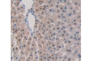 IHC-P analysis of Kidney tissue, with DAB staining. (BCOR 抗体  (AA 1553-1755))