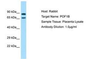 Image no. 1 for anti-Premature Ovarian Failure, 1B (POF1B) (AA 469-518) antibody (ABIN6750034) (POF1B 抗体  (AA 469-518))