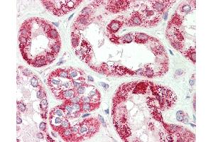 Human, Kidney: Formalin-Fixed Paraffin-Embedded (FFPE). (VARS 抗体  (AA 576-625))