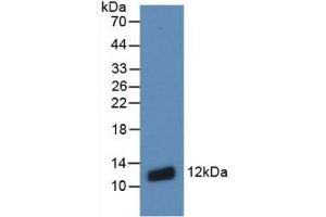 Detection of Recombinant S100A8, Human using Monoclonal Antibody to S100 Calcium Binding Protein A8 (S100A8) (S100A8 抗体  (AA 1-93))
