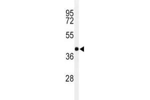 Western Blotting (WB) image for anti-Paired Box 6 (PAX6) (AA 352-380) antibody (ABIN3032127)