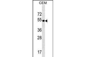 ELL3 Antibody (C-term) (ABIN1537150 and ABIN2849766) western blot analysis in CEM cell line lysates (35 μg/lane). (ELL3 抗体  (C-Term))