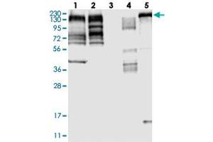 Western blot analysis of Lane 1: RT-4, Lane 2: U-251 MG, Lane 3: Human Plasma, Lane 4: Liver, Lane 5: Tonsil with MLLT4 polyclonal antibody  at 1:250-1:500 dilution. (Afadin 抗体)