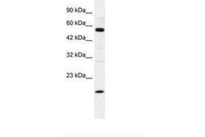 Image no. 1 for anti-Zinc Finger Protein 436 (ZNF436) (AA 104-153) antibody (ABIN202607) (ZNF436 抗体  (AA 104-153))