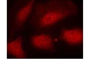 Image no. 3 for anti-Histone H3.1 (HIST1H3B) (pSer10) antibody (ABIN196922) (Histone H3.1 抗体  (pSer10))