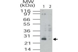 Western blot analysis of TMED4 in HL-60 cell lysates. (TMED4 抗体  (AA 55-67))