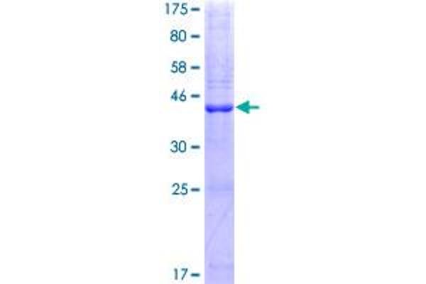 PLA2G10 Protein (AA 1-165) (GST tag)