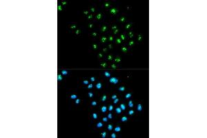 Immunofluorescence analysis of MCF-7 cells using EIF6 antibody. (EIF6 抗体  (AA 1-245))