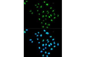 Immunofluorescence analysis of MCF-7 cells using EIF6 antibody. (EIF6 抗体  (AA 1-245))