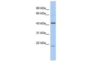 FAM98B antibody used at 1 ug/ml to detect target protein. (FAM98B 抗体  (N-Term))