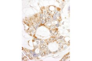 anti-Dedicator of Cytokinesis 4 (DOCK4) (AA 1725-1775) antibody