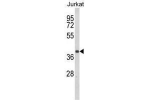 Western blot analysis of CCR3 Antibody (Center) in Jurkat cell line lysates (35ug/lane). (CCR3 抗体  (Middle Region))