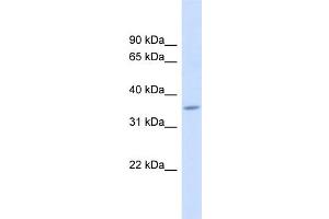 WB Suggested Anti-FAM26F Antibody Titration:  0. (FAM26F 抗体  (Middle Region))