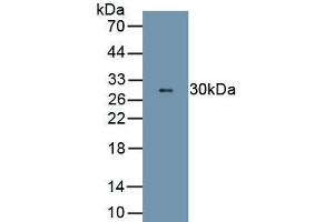 Detection of Recombinant ELA2, Rat using Polyclonal Antibody to Neutrophil Elastase (NE) (ELANE 抗体  (AA 31-271))