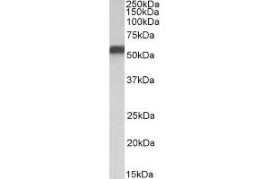 ABIN5857522 (1 µg/ml) staining of HepG2 nuclear lysate (35 µg protein in RIPA buffer). (NR5A2 + LRH1 抗体)