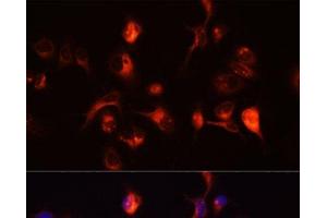 Immunofluorescence analysis of A431 cells using TOR1A Polyclonal Antibody at dilution of 1:100 (40x lens). (TOR1A 抗体)