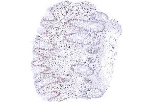 Rectum mucosa with a distinct p27 staining of epithelial cells at the surface but only weak or absent staining in the crypts