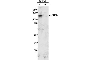 Western Blotting (WB) image for anti-General Transcription Factor III (GTF2I) (C-Term) antibody (ABIN7449365) (GTF2I 抗体  (C-Term))