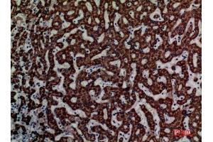 Immunohistochemistry (IHC) analysis of paraffin-embedded Human Liver, antibody was diluted at 1:100.
