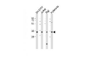 All lanes : Anti-RASSF2 Antibody (Center) at 1:2000 dilution Lane 1: SH-SY5Y whole cell lysates Lane 2: Jurkat whole cell lysates Lane 3: Raji whole cell lysates Lane 4: human placenta lysates Lysates/proteins at 20 μg per lane. (RASSF2 抗体  (AA 123-156))