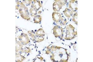 Immunohistochemistry of paraffin-embedded human stomach using RBP2 antibody. (RBP2 抗体  (AA 1-134))