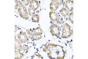 Immunohistochemistry of paraffin-embedded human stomach using RBP2 antibody. (RBP2 抗体  (AA 1-134))