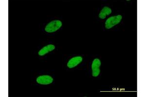 Immunofluorescence (IF) image for anti-SWI/SNF Related, Matrix Associated, Actin Dependent Regulator of Chromatin, Subfamily A, Member 5 (SMARCA5) (AA 1-1052) antibody (ABIN521924)