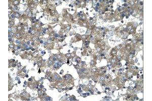 Image no. 1 for anti-Kruppel-Like Factor 15 (KLF15) (AA 45-94) antibody (ABIN202473) (KLF15 抗体  (AA 45-94))